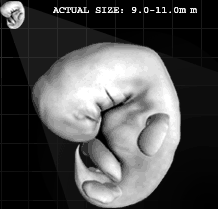 human fetus after 45 days of development