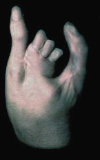 hand